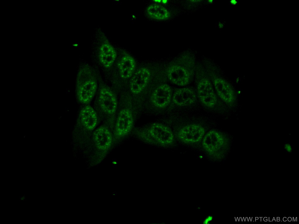SPI1 Polyclonal antibody