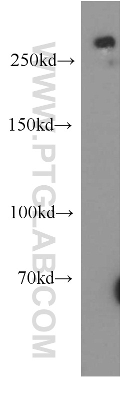 SPTBN2 Polyclonal antibody