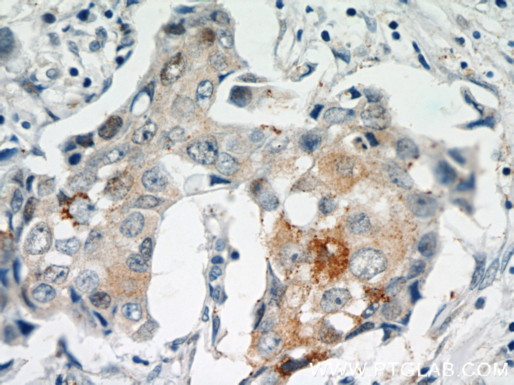 MAGEA4 Polyclonal antibody