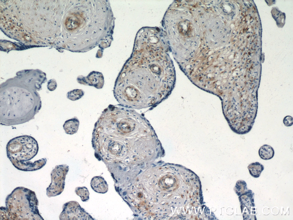 S1PR1/EDG1 Polyclonal antibody