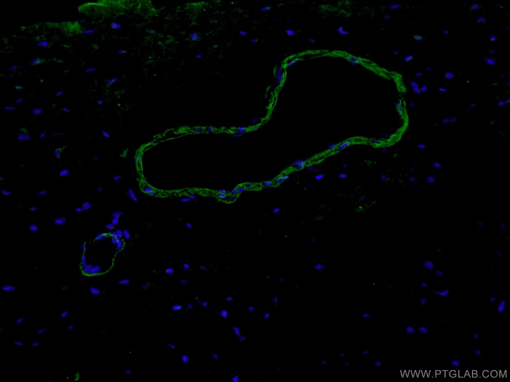 smooth muscle actin-specific Polyclonal antibody