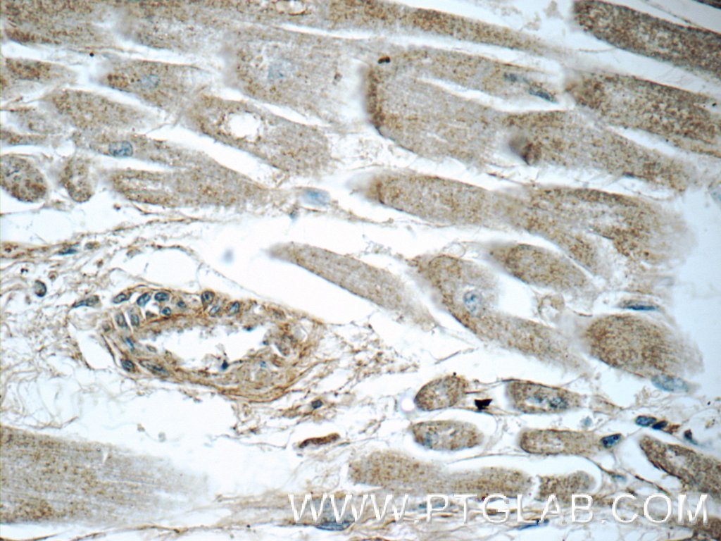 LTB4R Polyclonal antibody