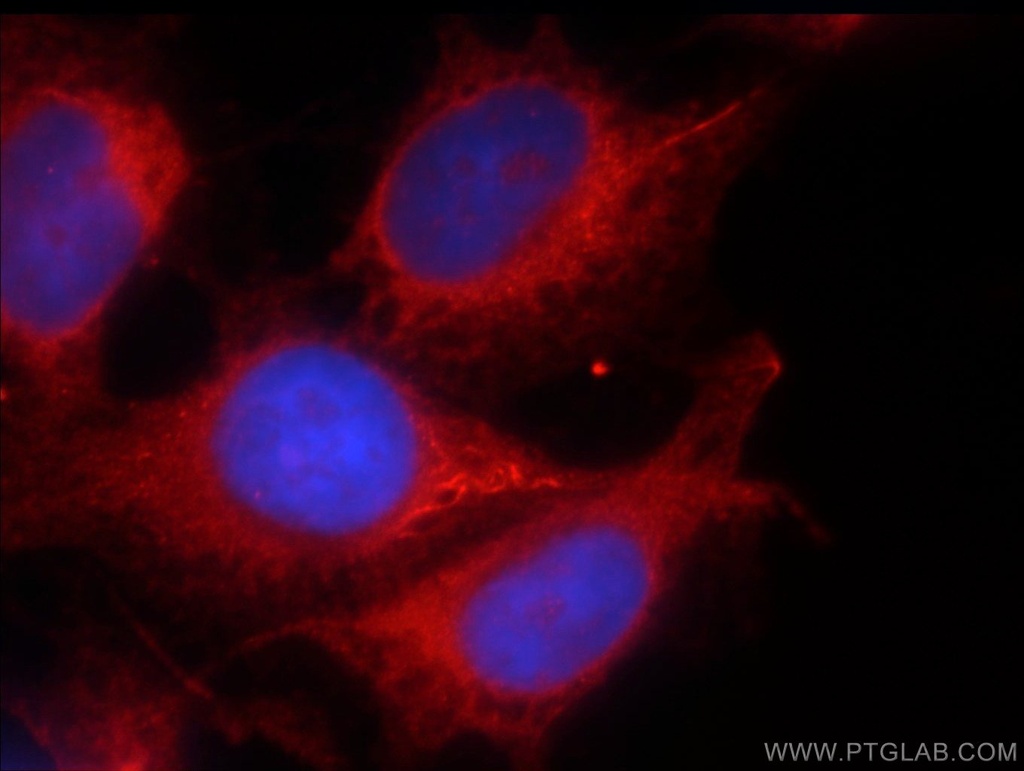 PRKG2 Polyclonal antibody