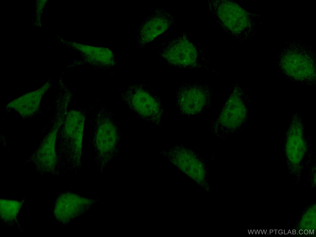 PARP2 Polyclonal antibody