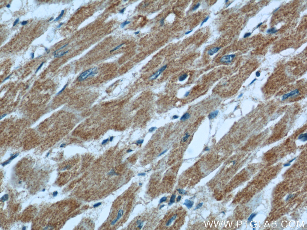 LNPEP Polyclonal antibody
