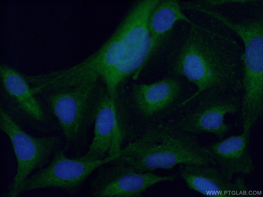 PPP3CC-specific Polyclonal antibody