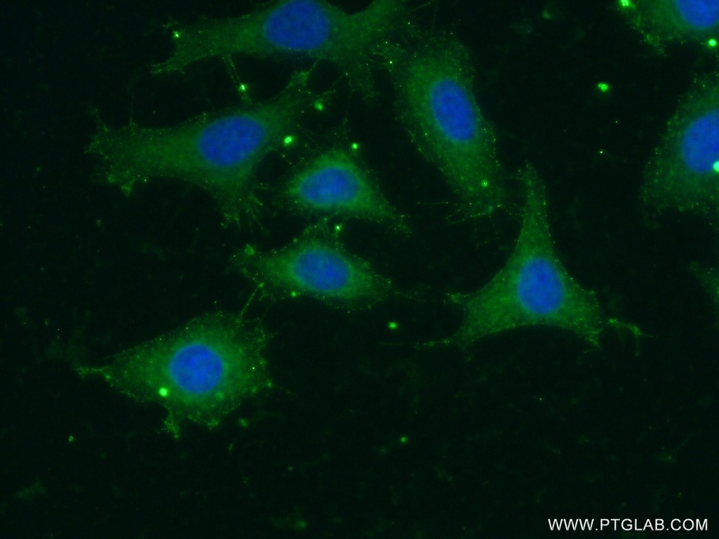 GNAT1 Polyclonal antibody