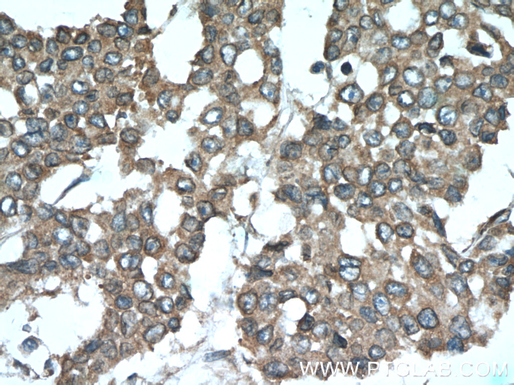 SMURF1 Polyclonal antibody