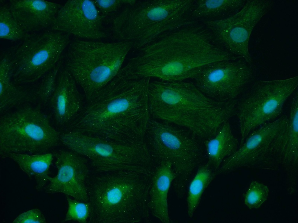 CSNK1A1 Polyclonal antibody