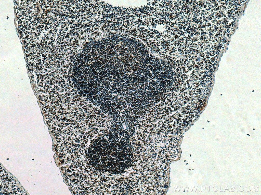 SET/TAF-I Polyclonal antibody