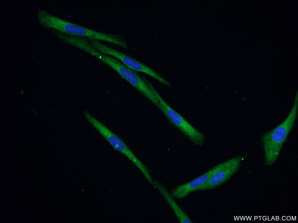 IGFBP5 Polyclonal antibody