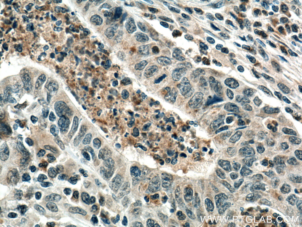 PCSK9 Polyclonal antibody