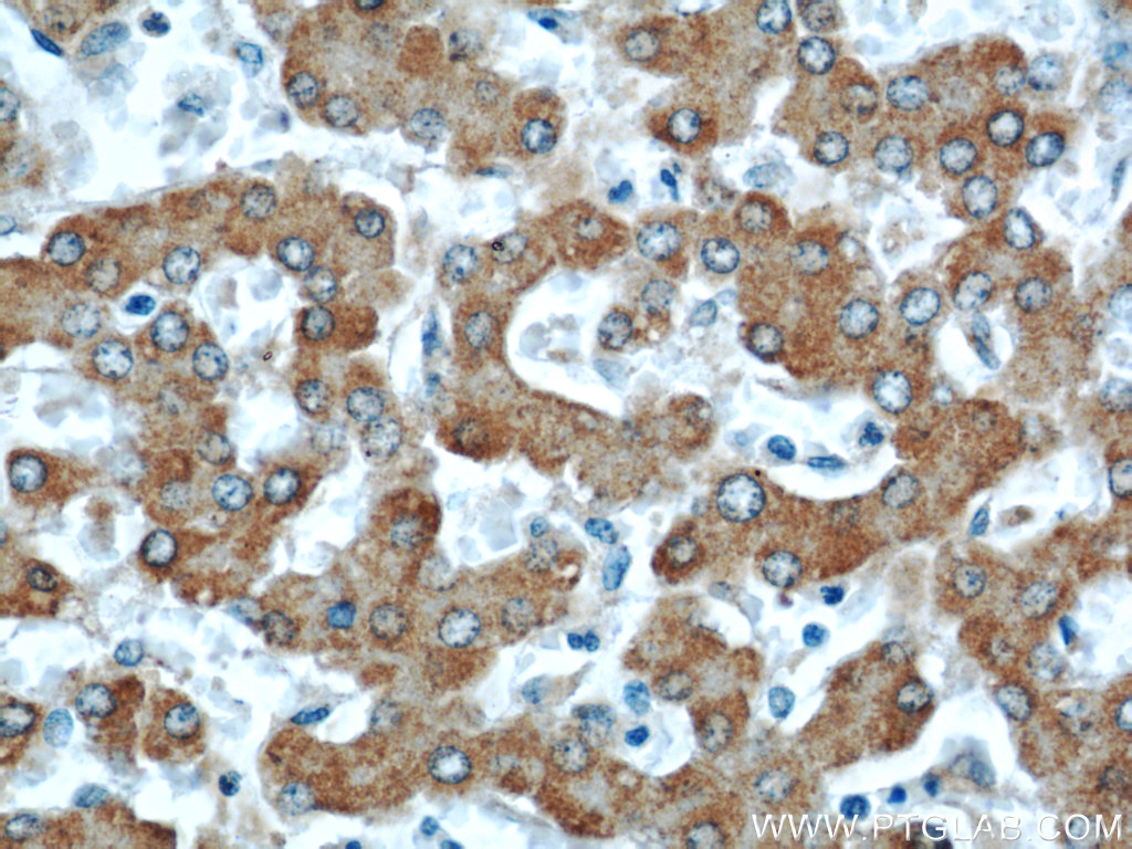 ACADM Polyclonal antibody