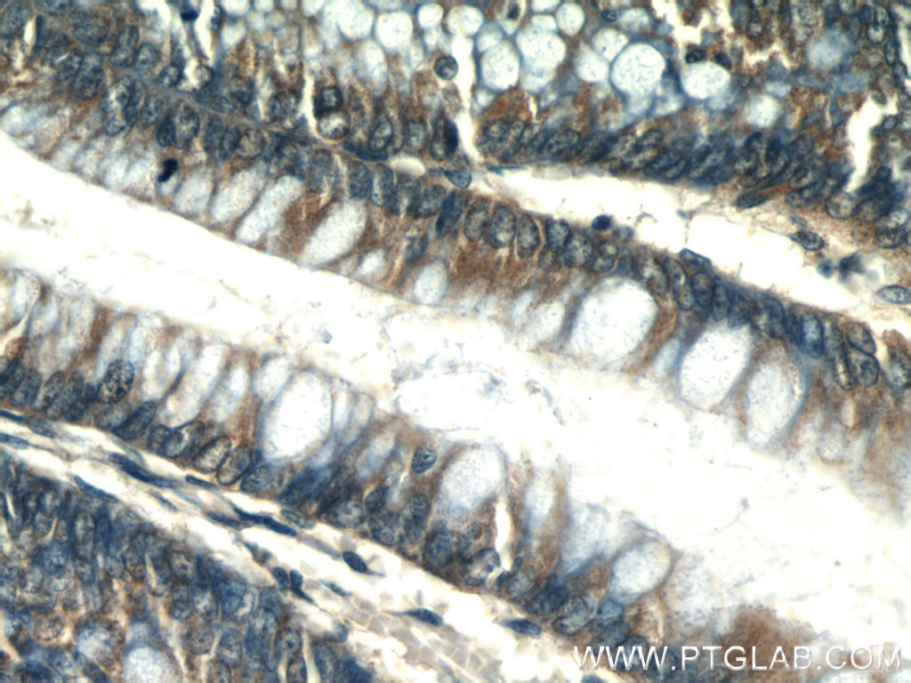 PLS1 Polyclonal antibody