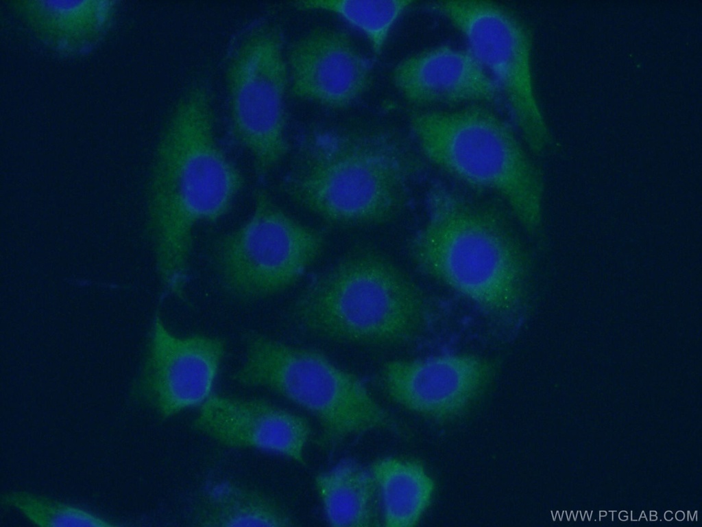 EPHA5 Polyclonal antibody