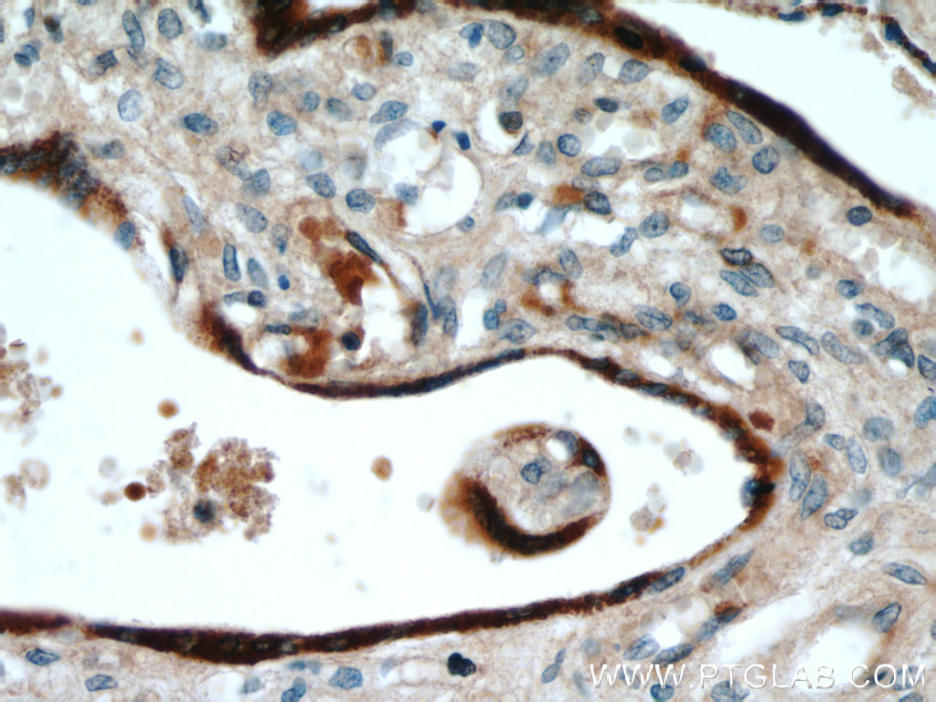 GH2 Polyclonal antibody