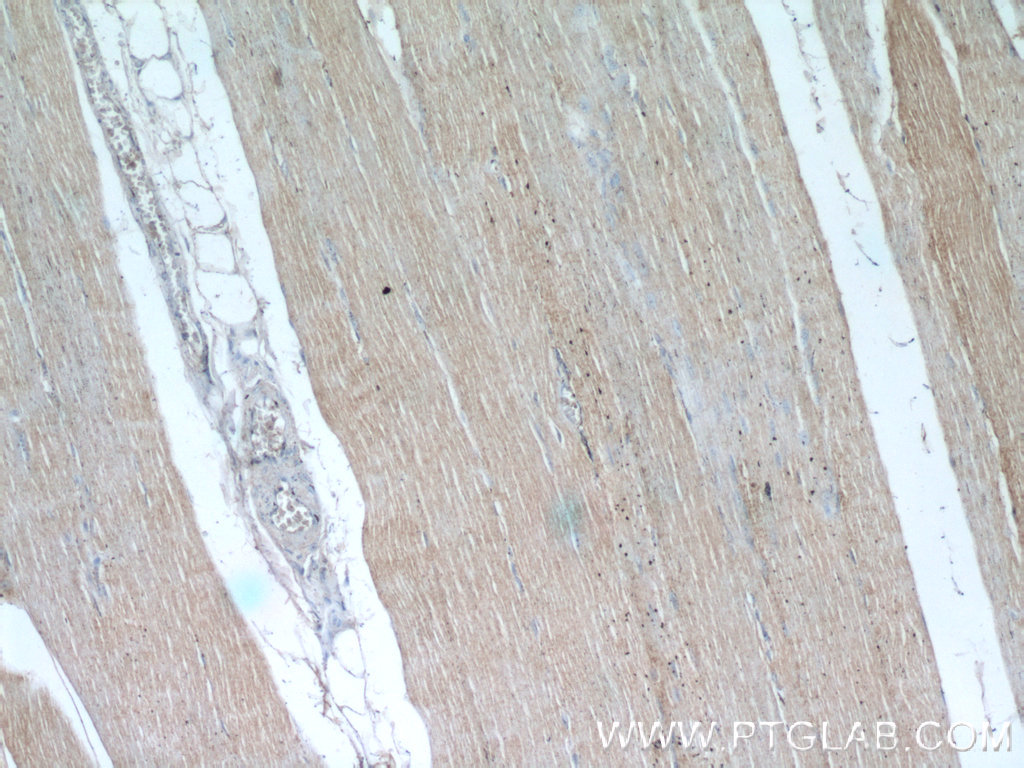 OBSCN Polyclonal antibody