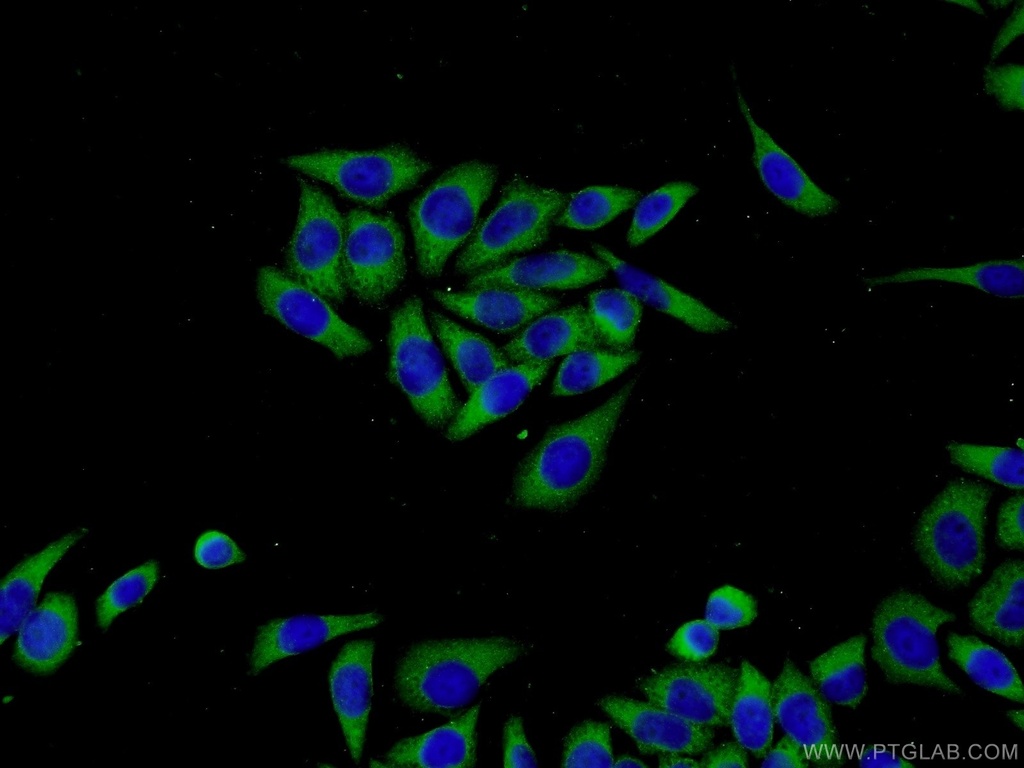 MMP21 Polyclonal antibody