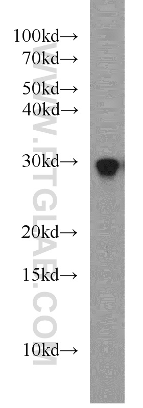 RAB8B Polyclonal antibody