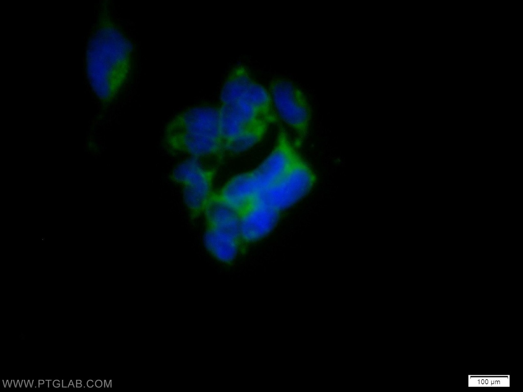 SH2D5 Polyclonal antibody