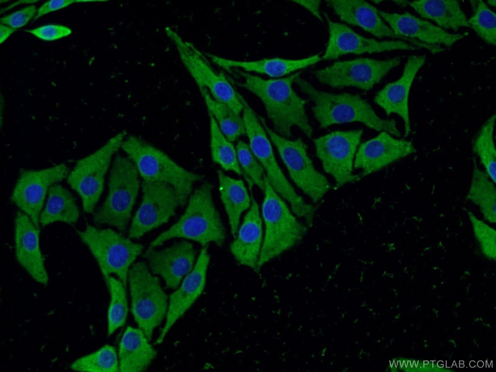 SCN10A Polyclonal antibody