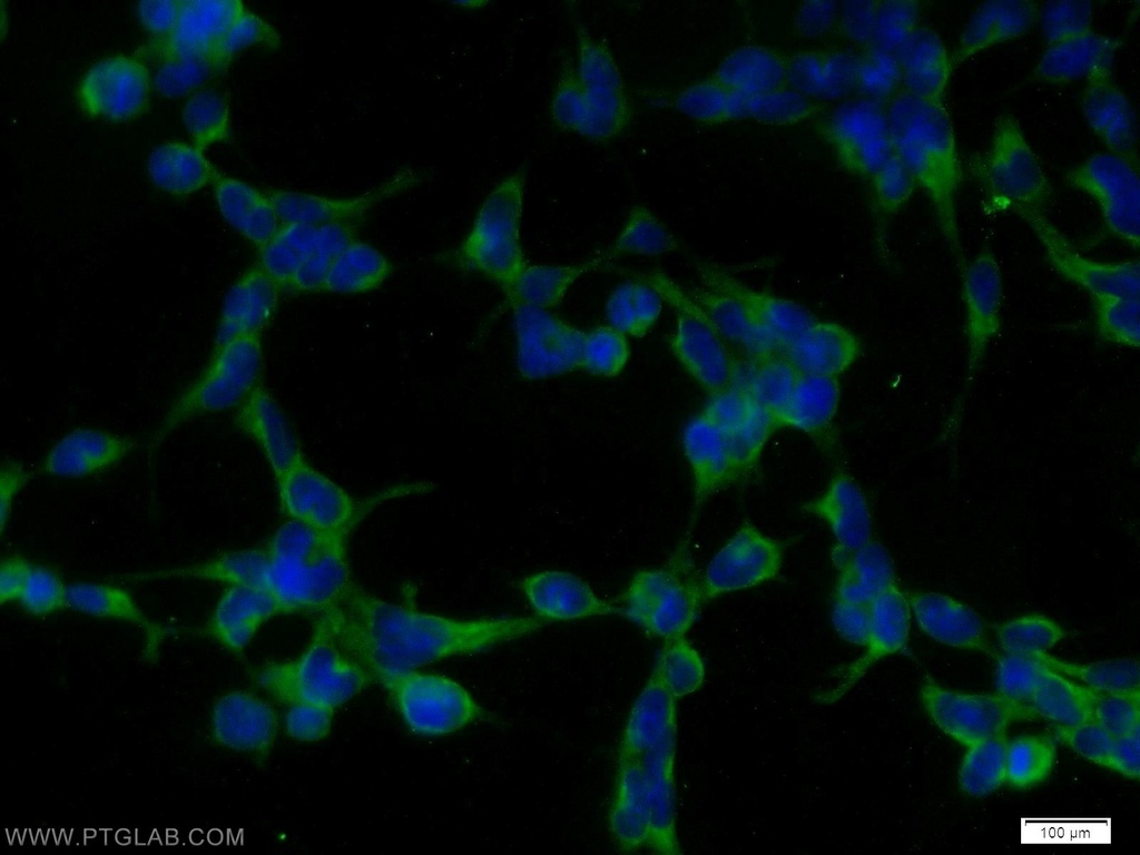 STK38 Polyclonal antibody