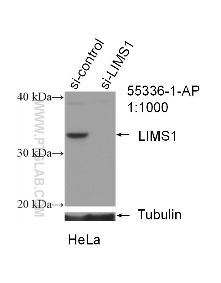 LIMS1 Polyclonal antibody
