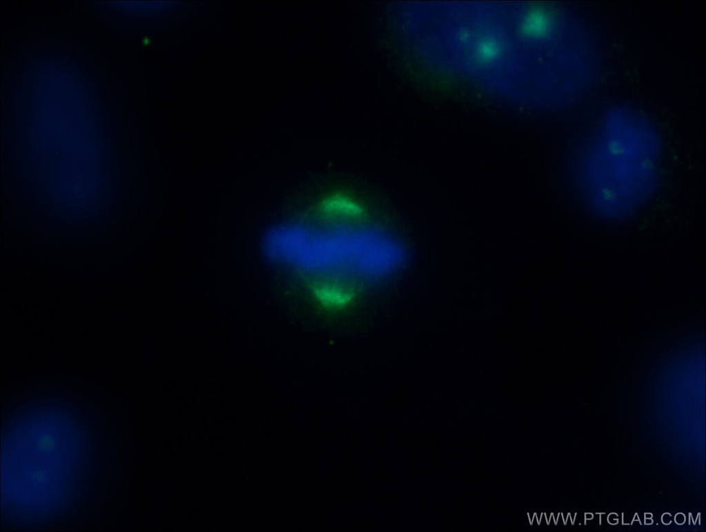 CEP78 Polyclonal antibody