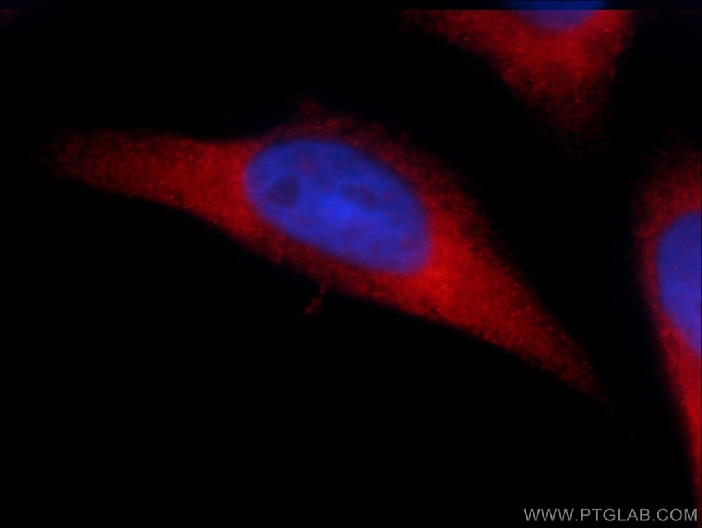 SIDT1 Polyclonal antibody