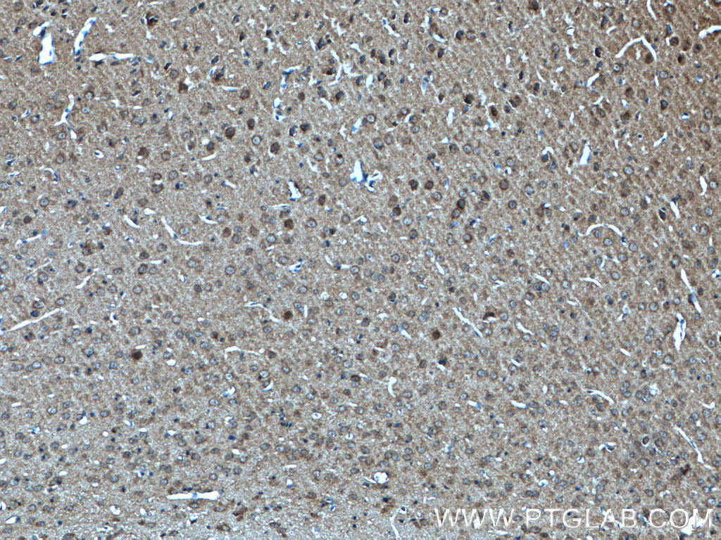 p140Cap Polyclonal antibody