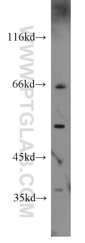 HLA-F Polyclonal antibody