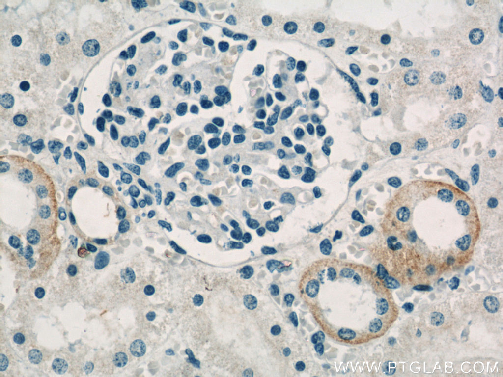 PKA C-beta-specific Polyclonal antibody