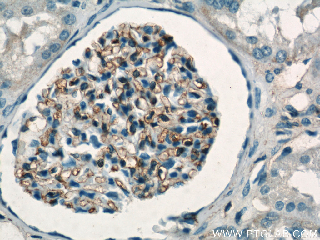 HLA-A Polyclonal antibody