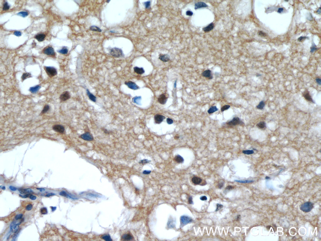 IMPDH2-specific  Polyclonal antibody