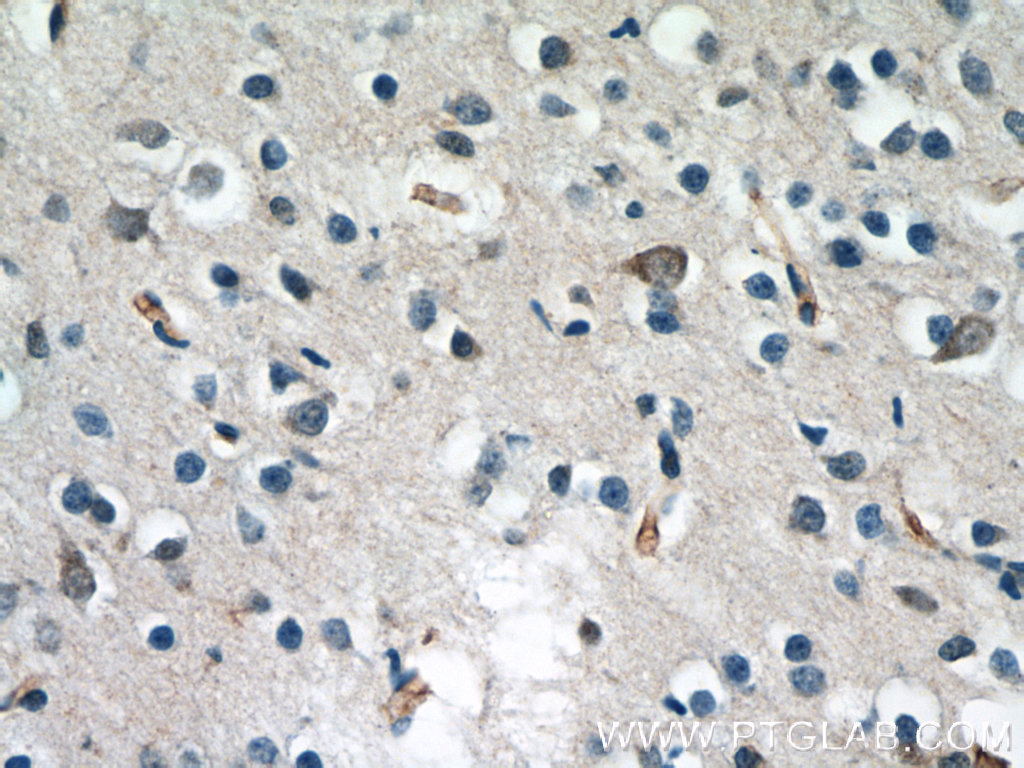 ND5 Polyclonal antibody