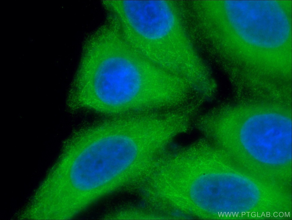 CYP3A7 Polyclonal antibody