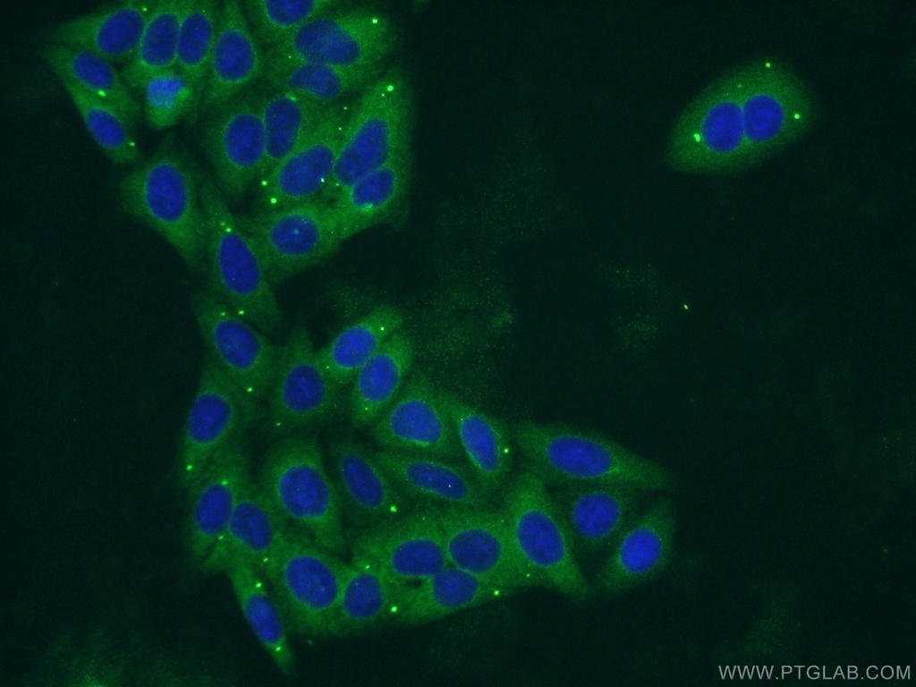 PYGL Polyclonal antibody