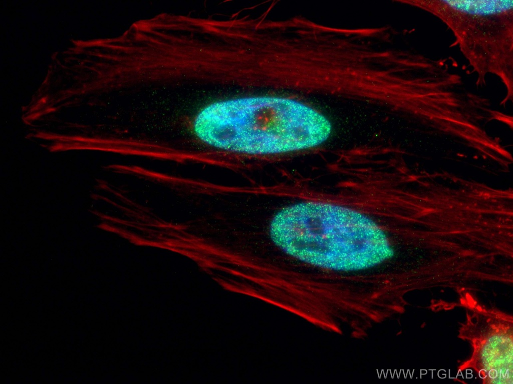 ESR2 Beta 6 Polyclonal antibody