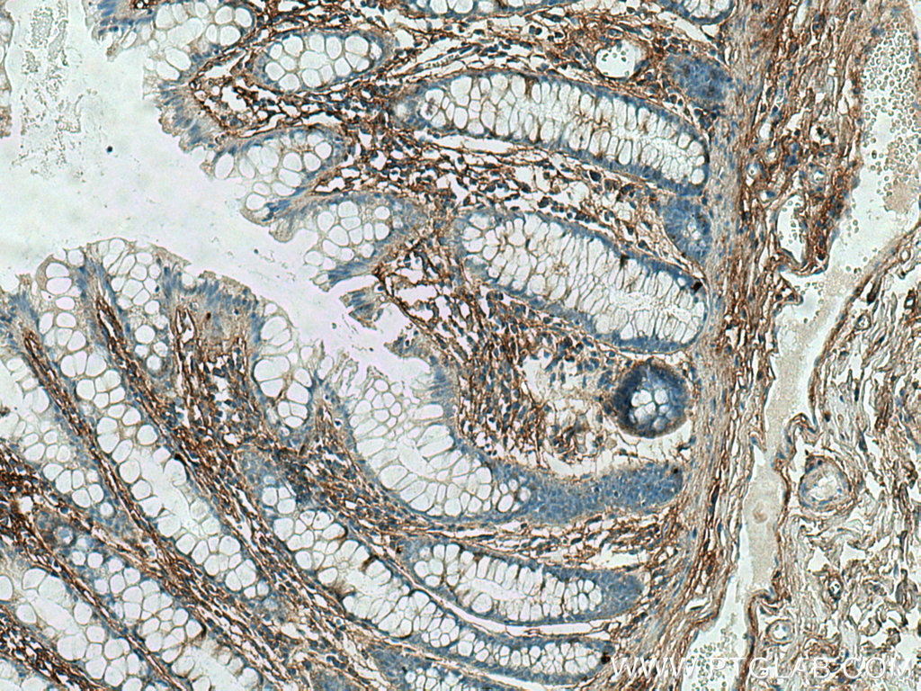TGFBI / BIGH3 Monoclonal antibody