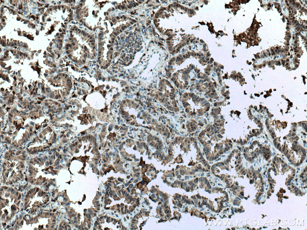 S100A11 Monoclonal antibody