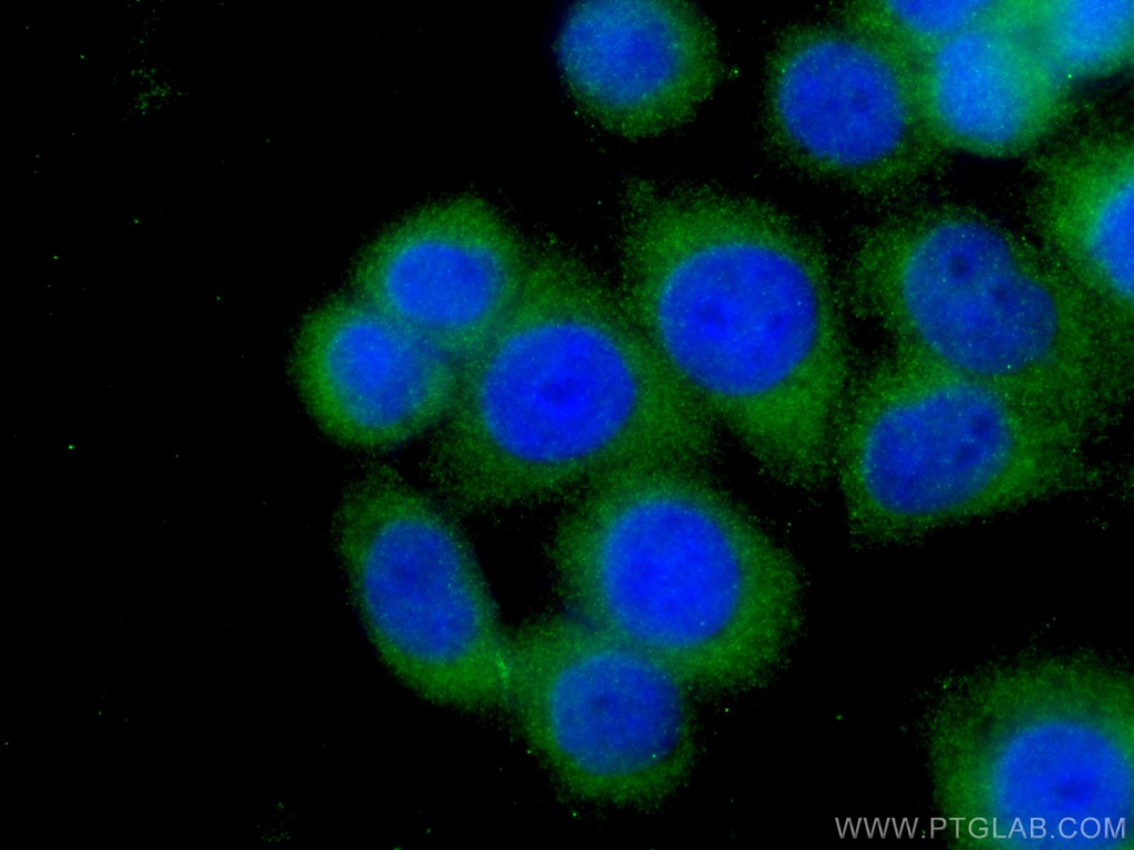 Stanniocalcin 2 Monoclonal antibody