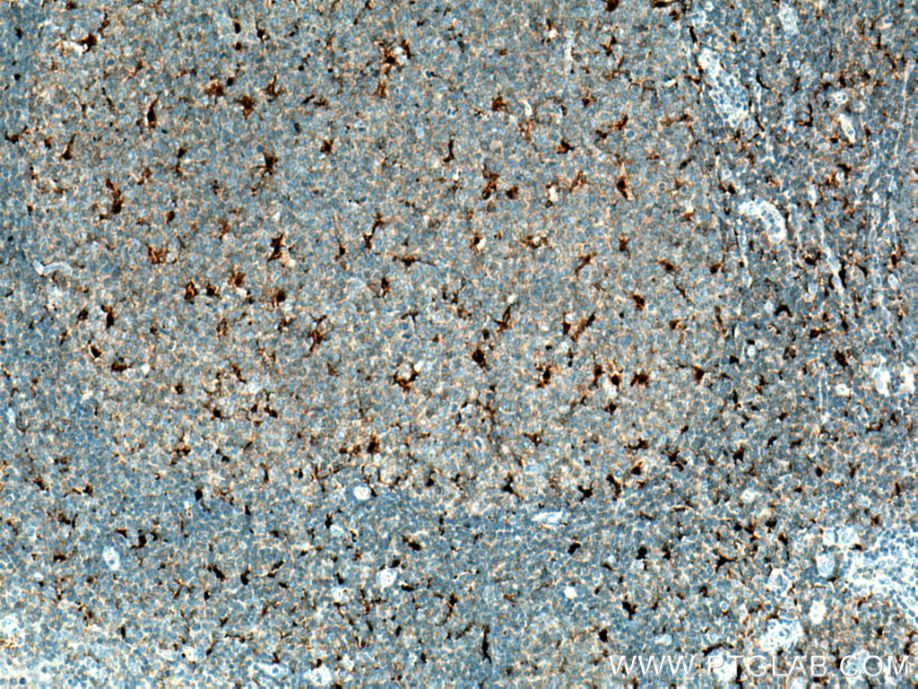 IL-18 Monoclonal antibody
