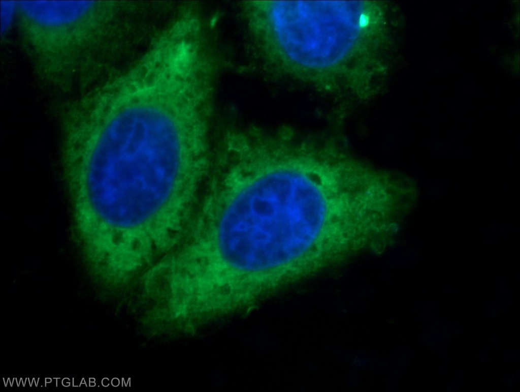RRM1 Monoclonal antibody