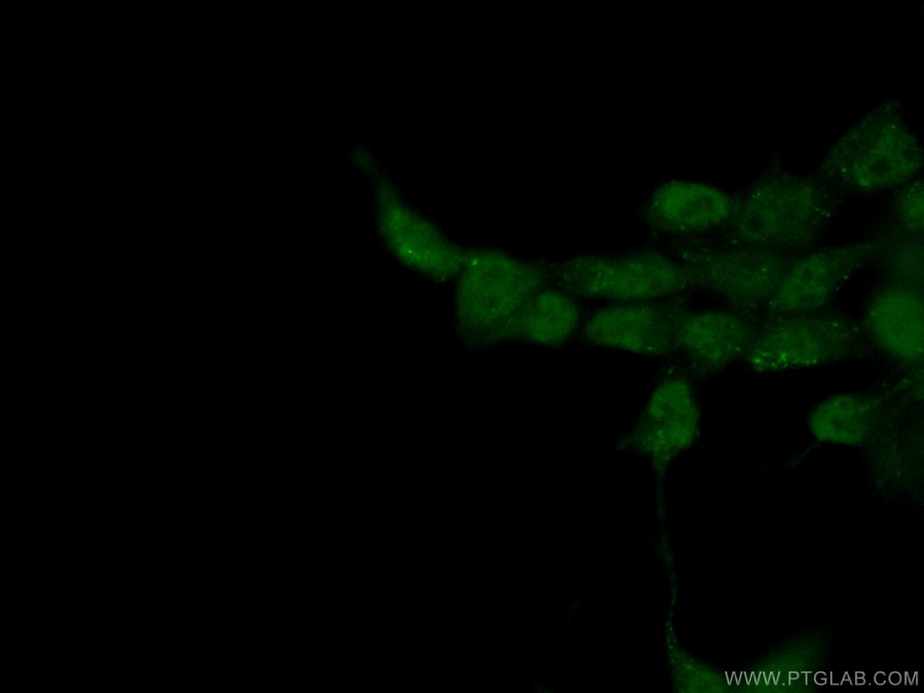 BRD8 Monoclonal antibody