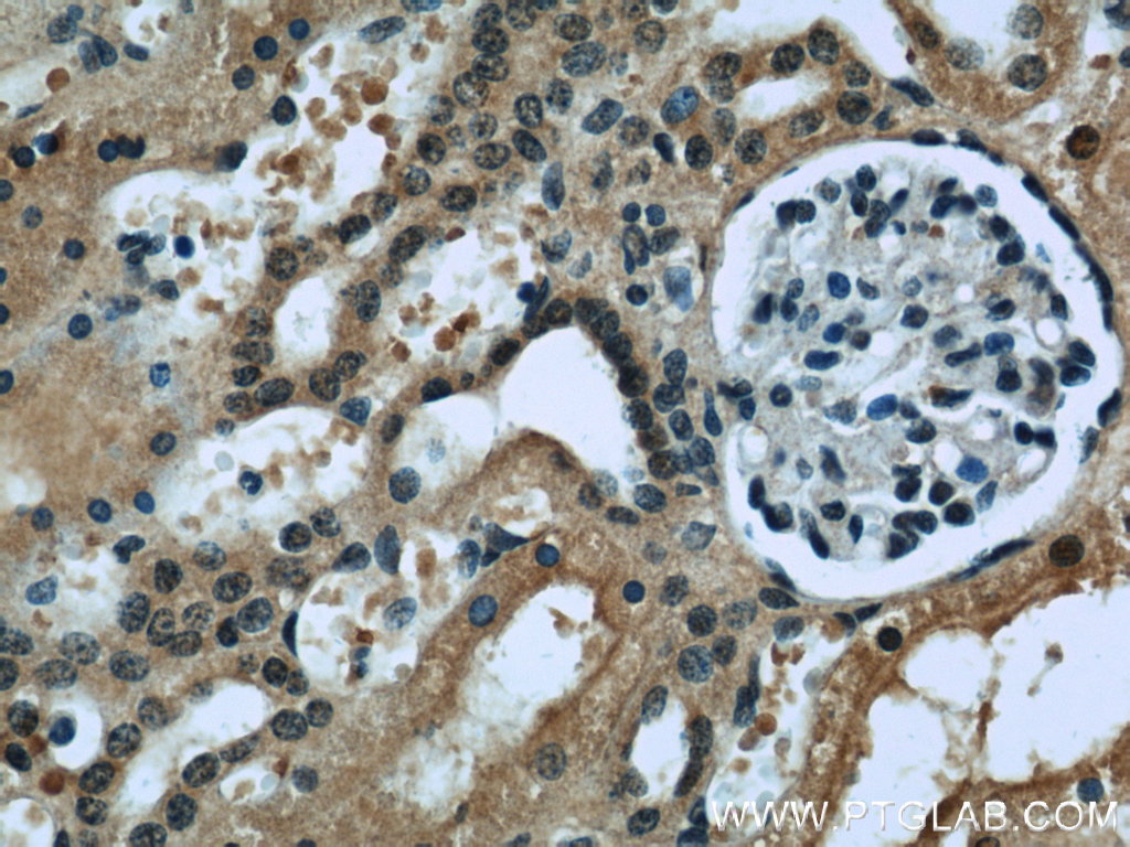 RENALASE Monoclonal antibody