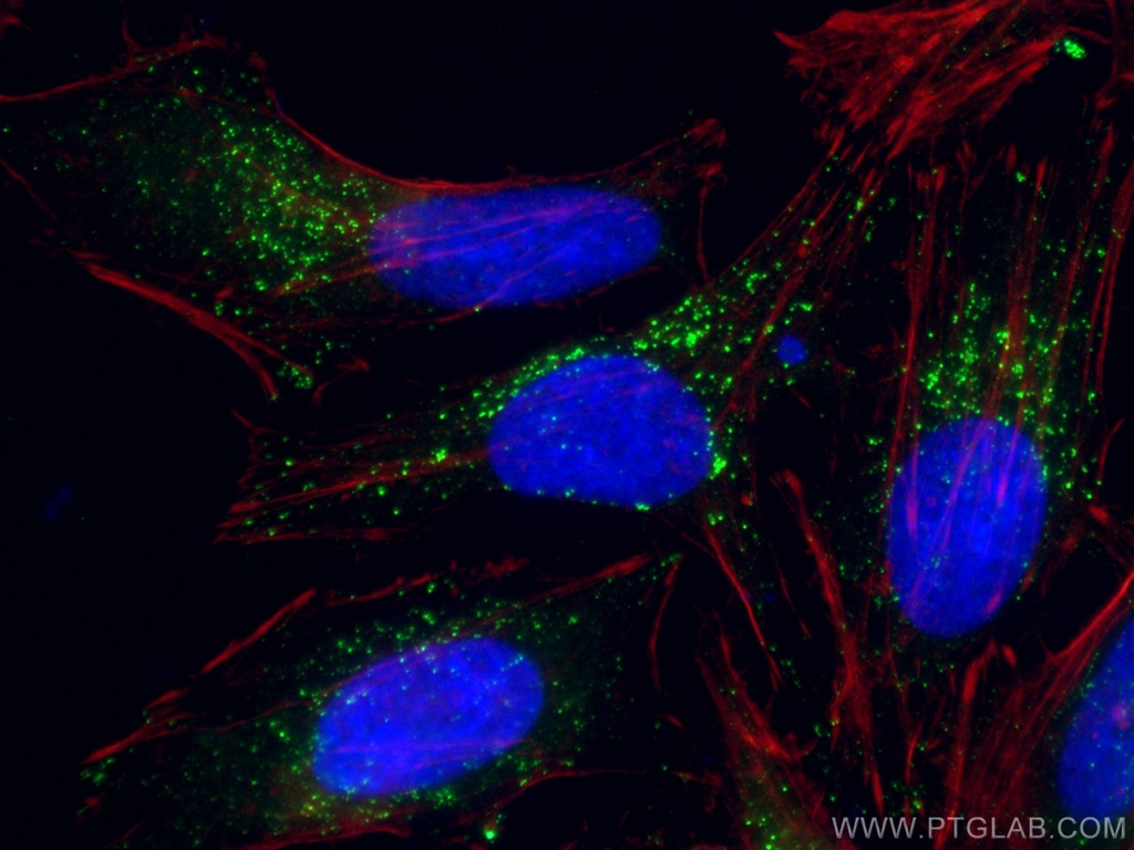 ABCD1 Monoclonal antibody