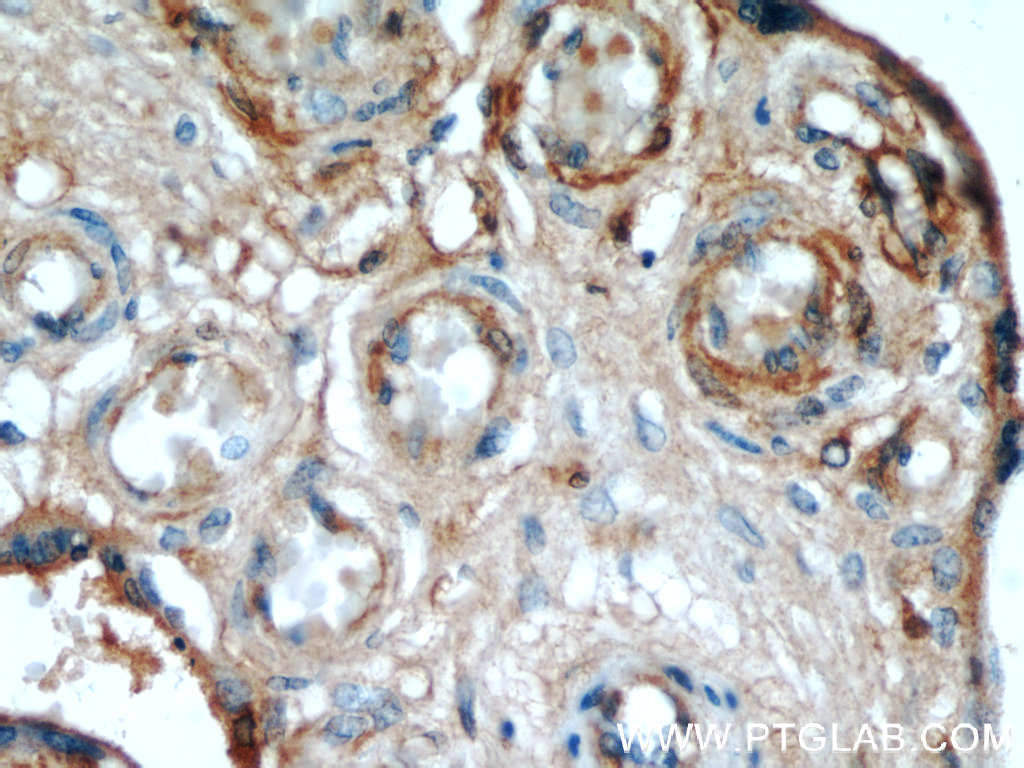 AMOT Monoclonal antibody