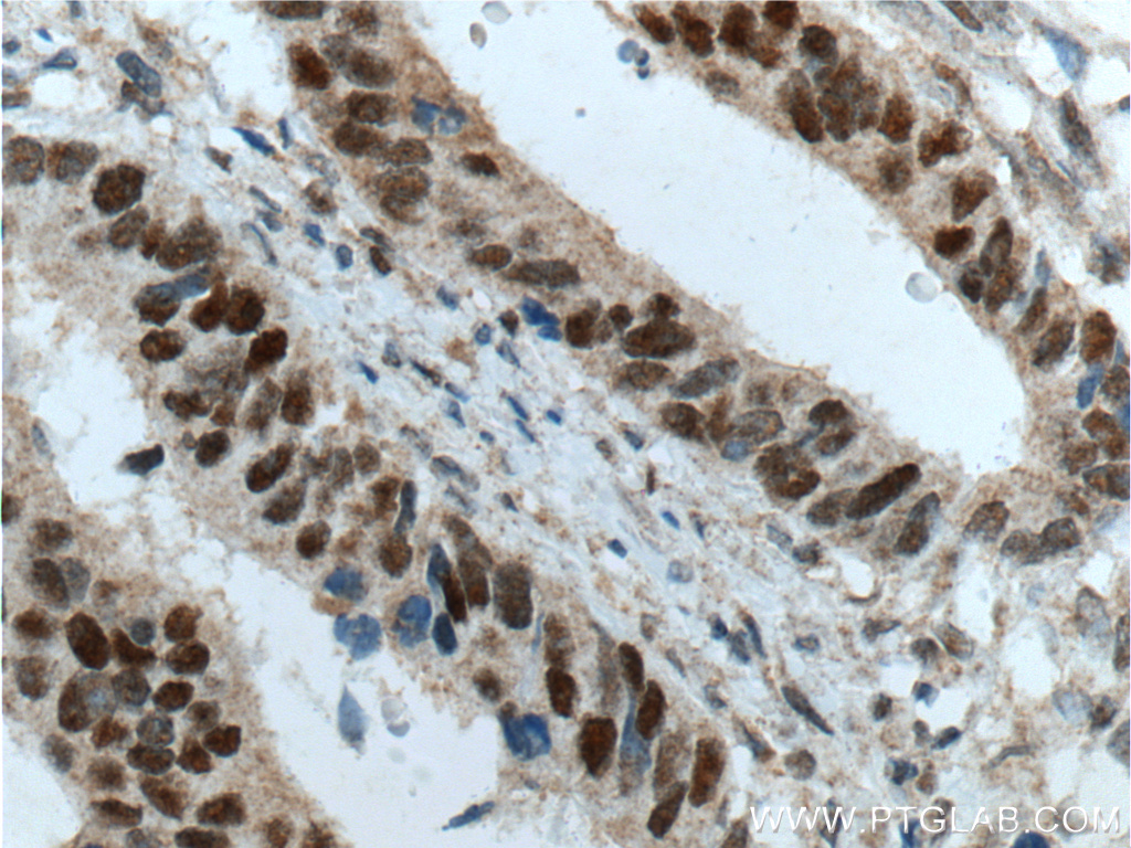 MSH2 Monoclonal antibody