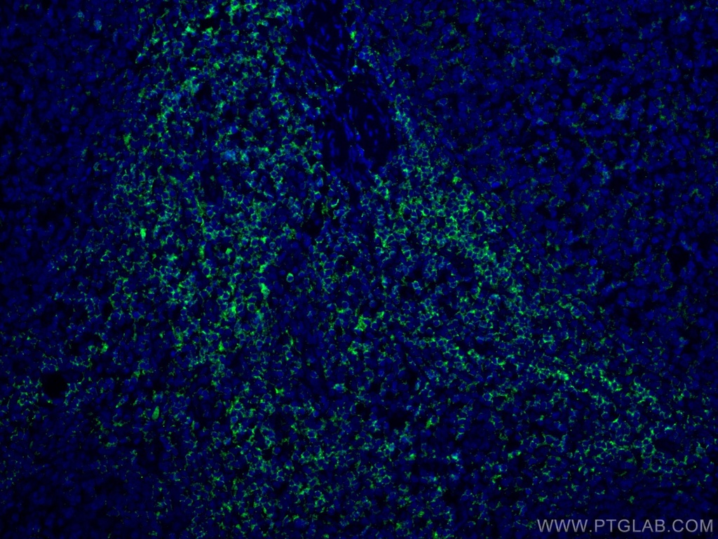 LCK Monoclonal antibody