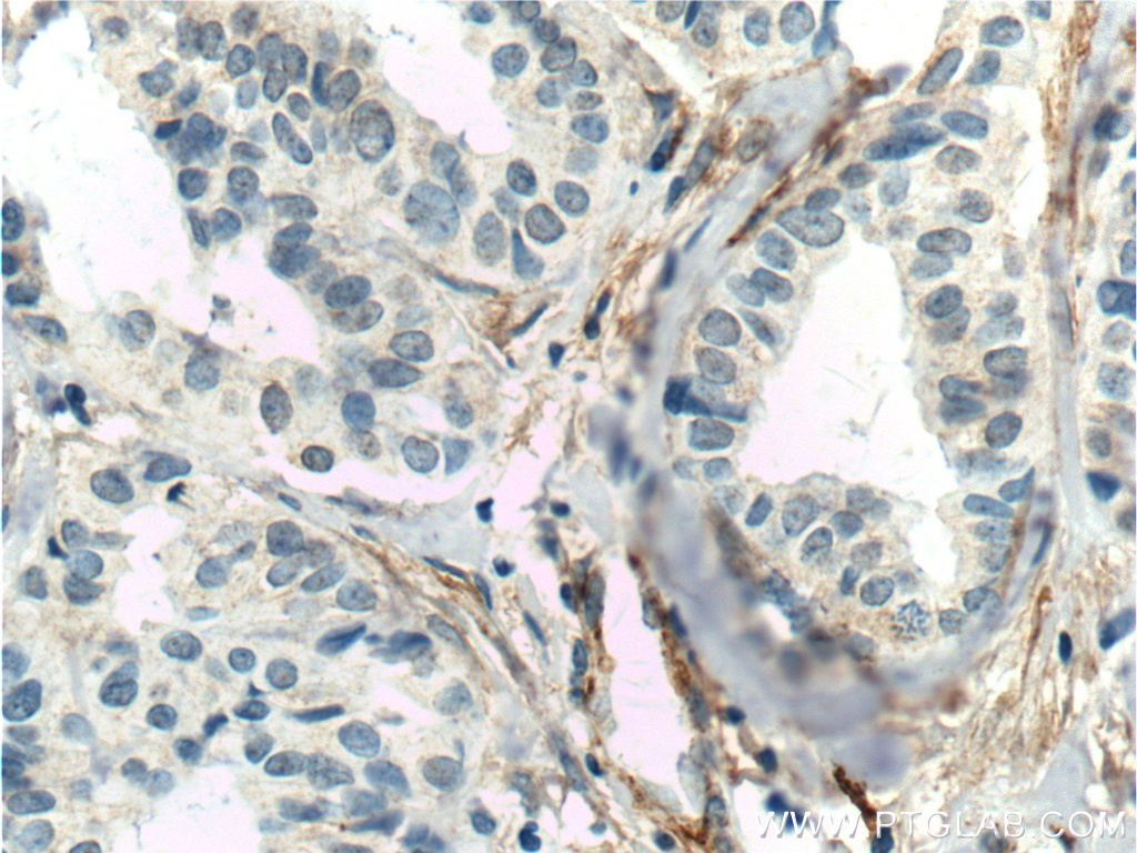 TEM1 Monoclonal antibody